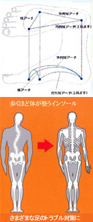 姿勢インソール