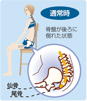 猫背など悪い姿勢