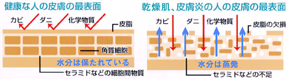 セラミドによる肌バリア機能