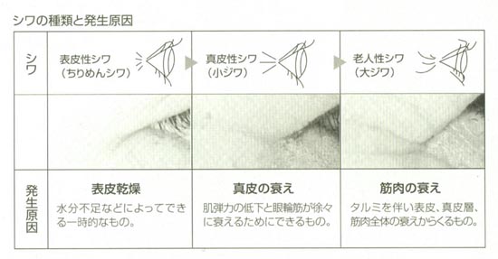 目元のしわ 目尻の小じわ